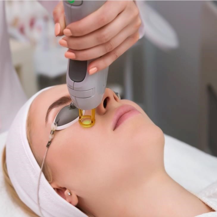 Laser hair removal named most popular treatment for PCOS sufferers