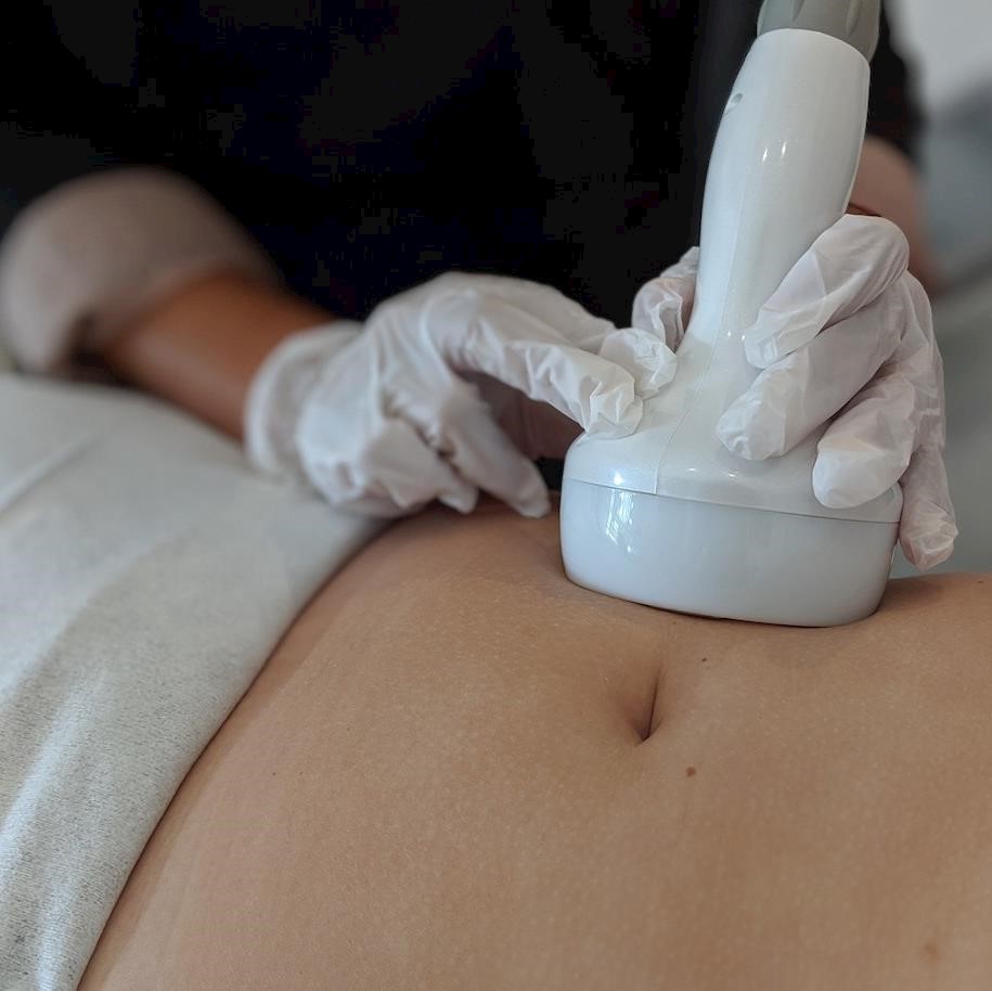 How to boost your income with radiofrequency skin tightening  