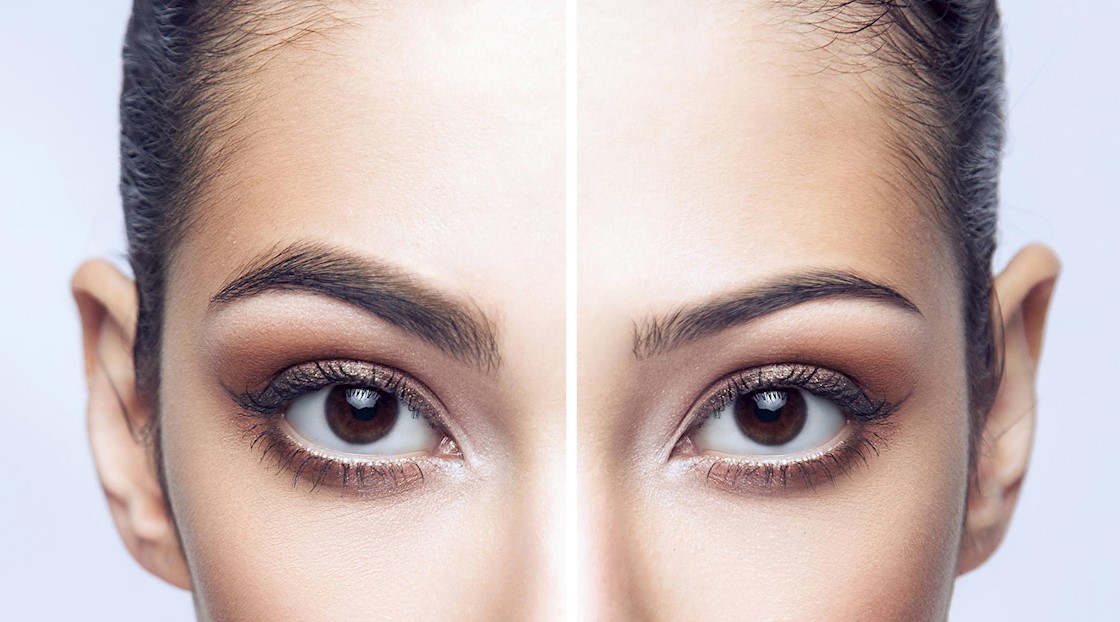 [Updated] The reasons for thinning eyebrows and the treatments that can help