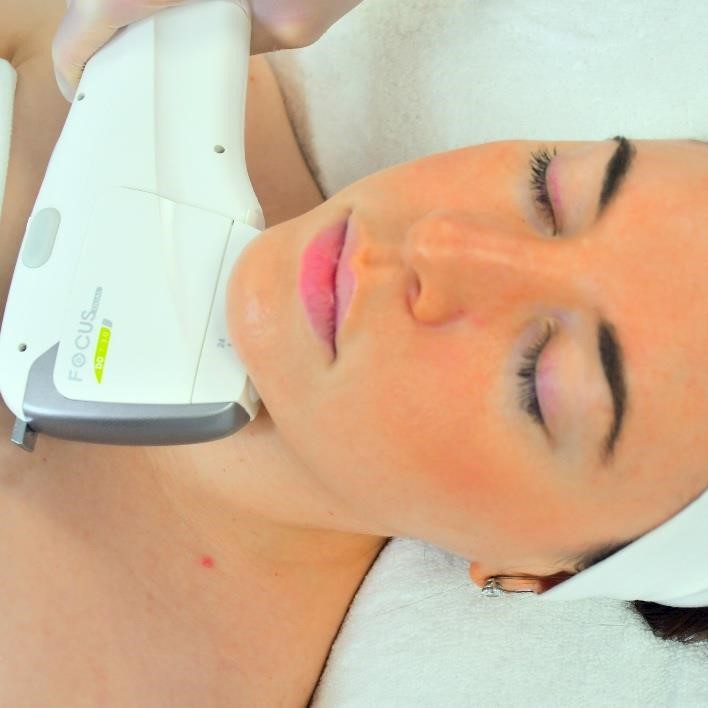 How to introduce RF microneedling and HIFU into your clinic or salon