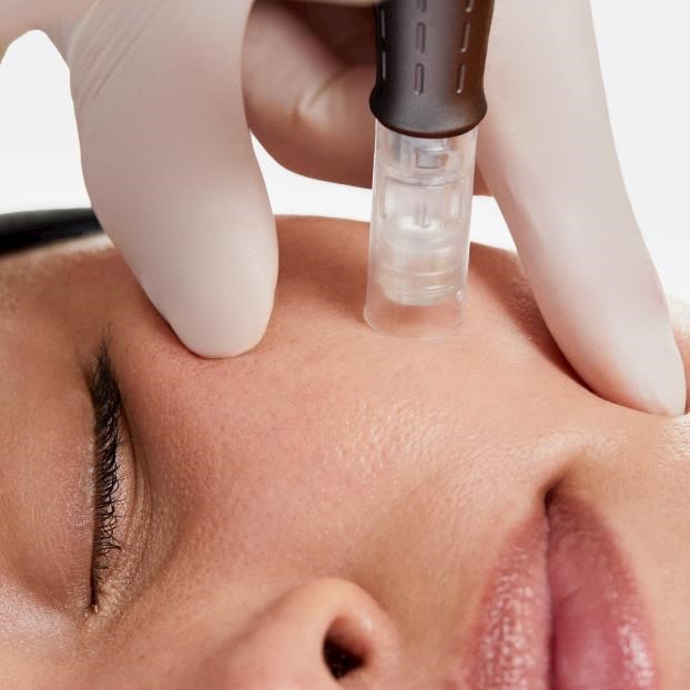 How to achieve superior microneedling results