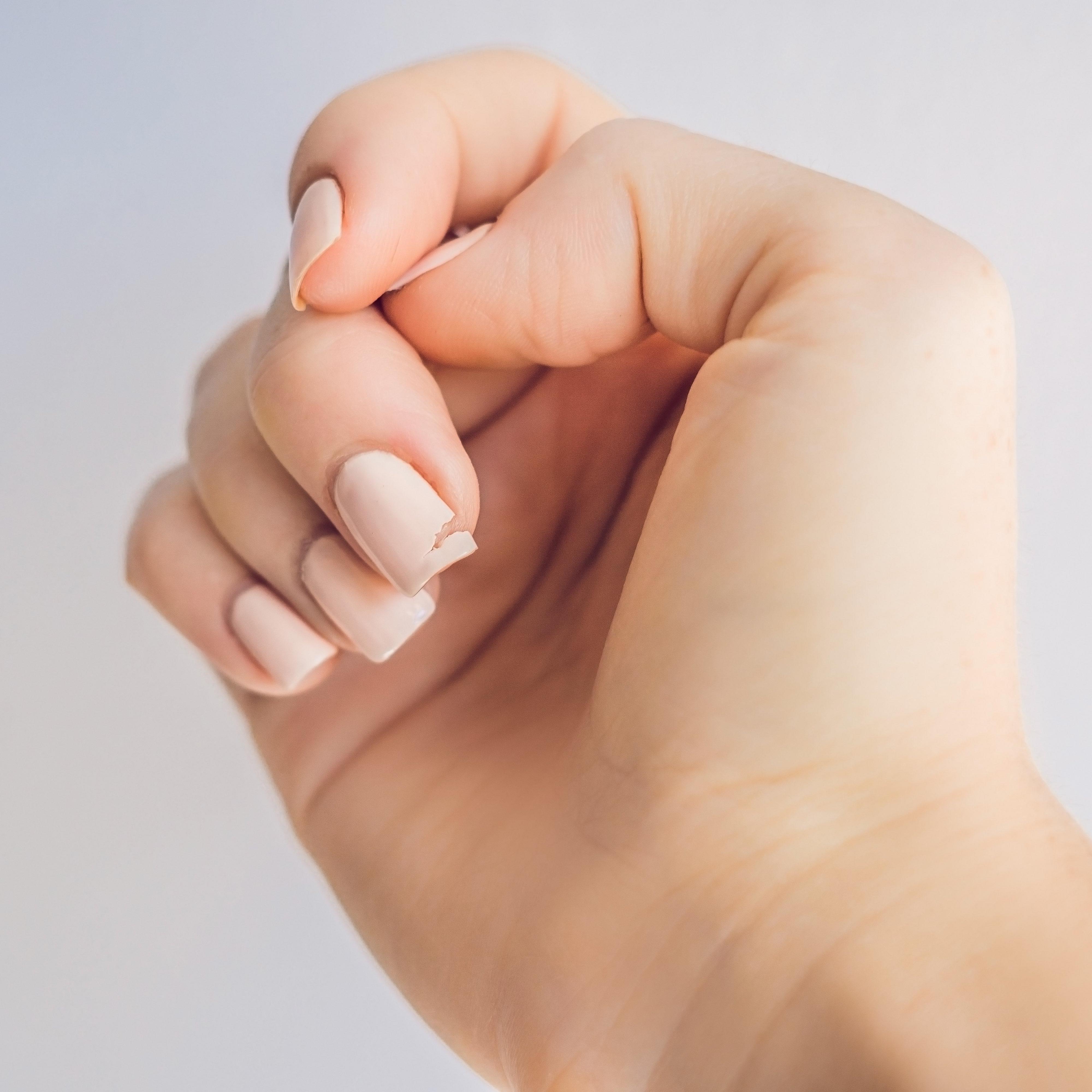 Nail advice: how to prevent lifting