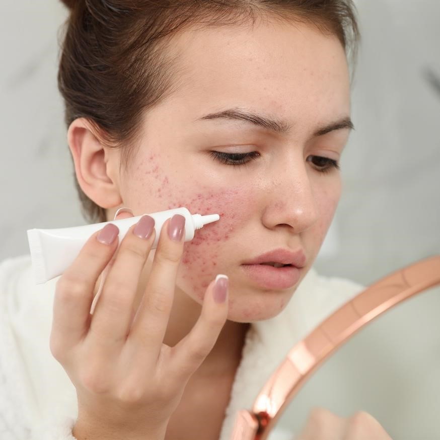 A fifth of Brits are using a potentially damaging product to treat their skin condition