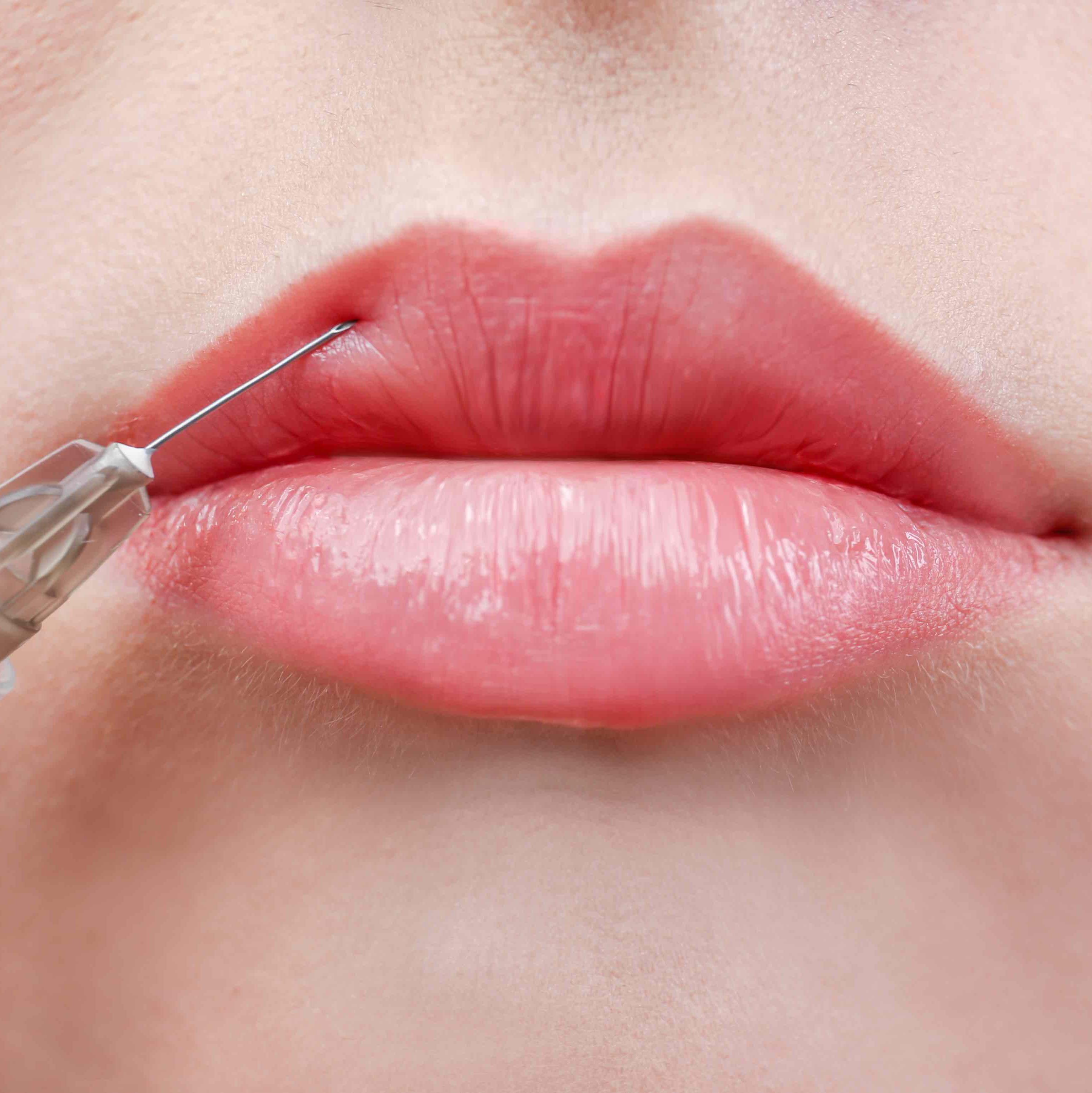 Amazon and eBay selling self-inject filler kits for under £50