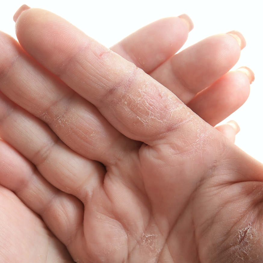 US study finds 52% of regular salon-goers have caught dermal or fungal diseases