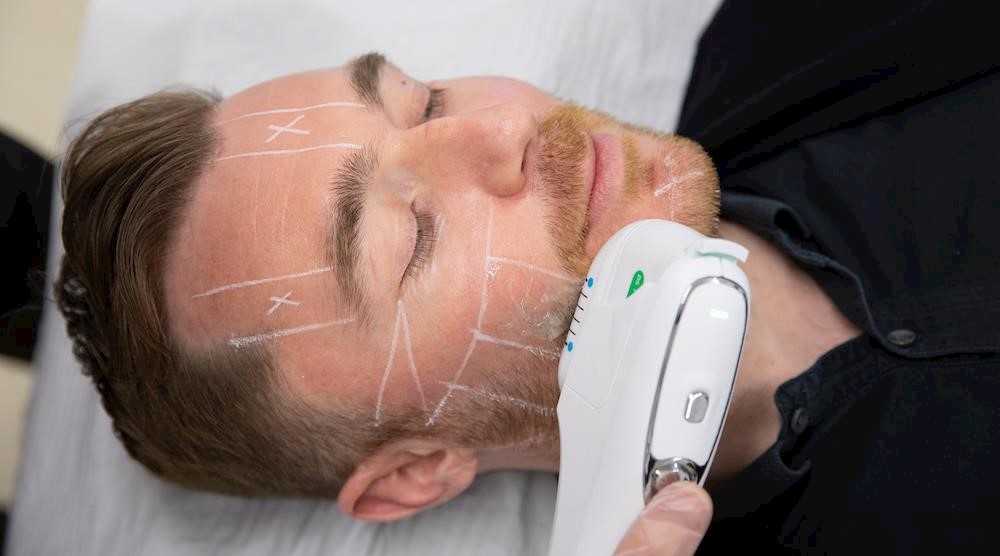 HIFU: The ultimate non-invasive alternative for male skin tightening