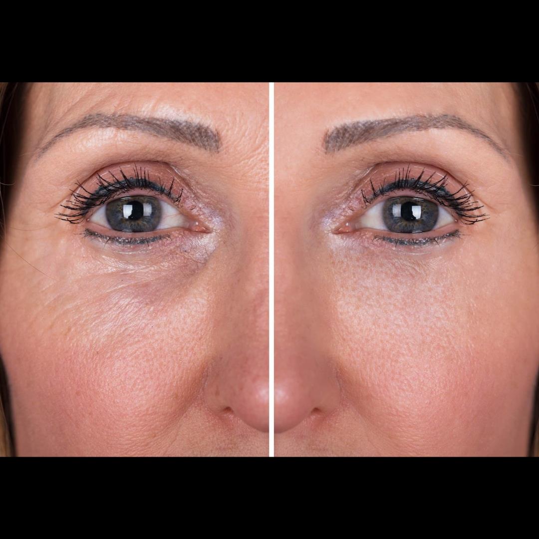 How to take the best before-and-after photos of your clients