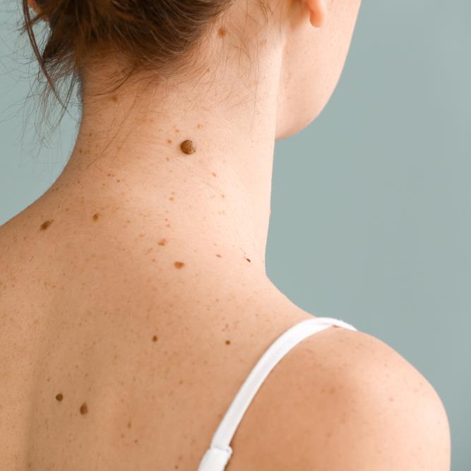 Should therapists understand early skin cancer detection?